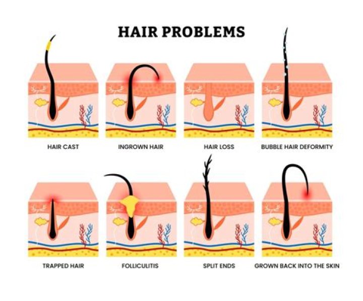 An Expert Reveals Common Indian Hair Concerns And Their Solutions