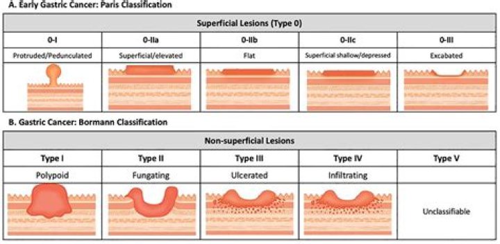 Ray Barlow Obituary, Palmdale CAL, Ray Barlow Has Died Following Long Time Battle With Stage 4 Gastric Cancer